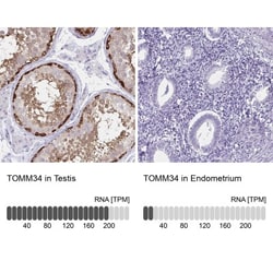 TOMM34 Antibody, Novus Biologicals 0.1mL; Unlabeled:Antibodies, Polyclonal